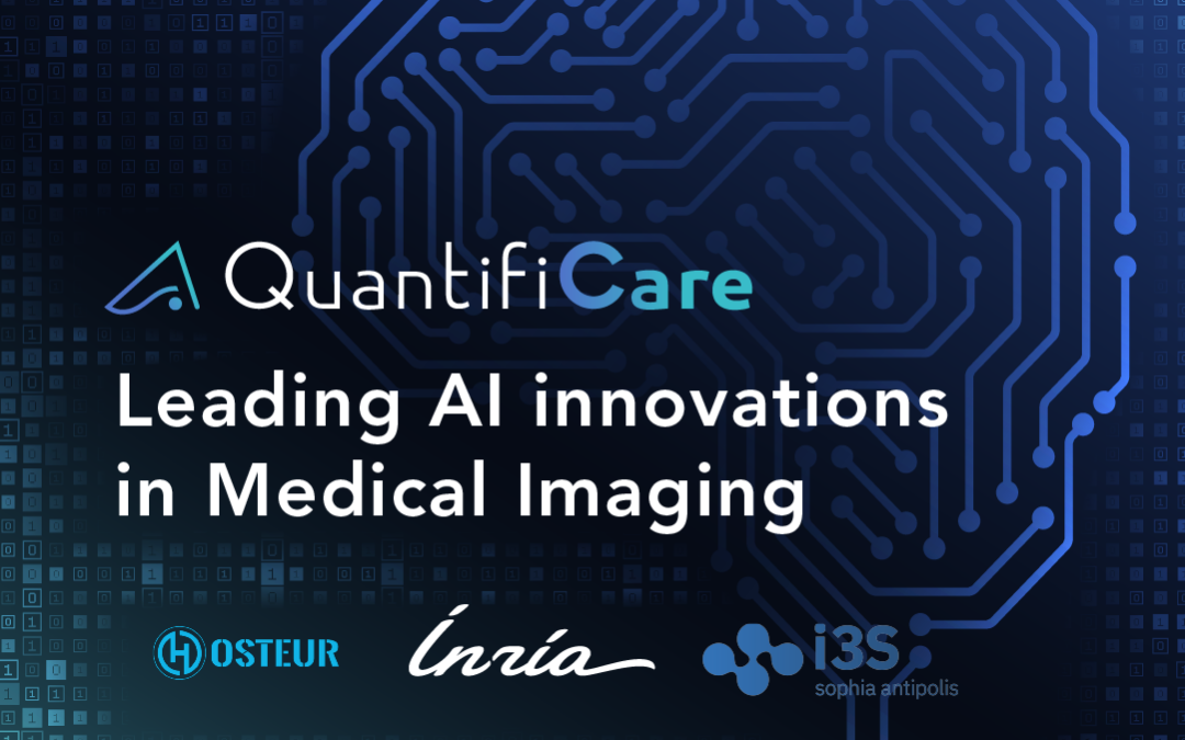 Revolutionizing Medical Imaging: QuantifiCare partners with Inria, i3S (CNRS) and Hosteur to Advance AI innovations to Improve Health Outcomes